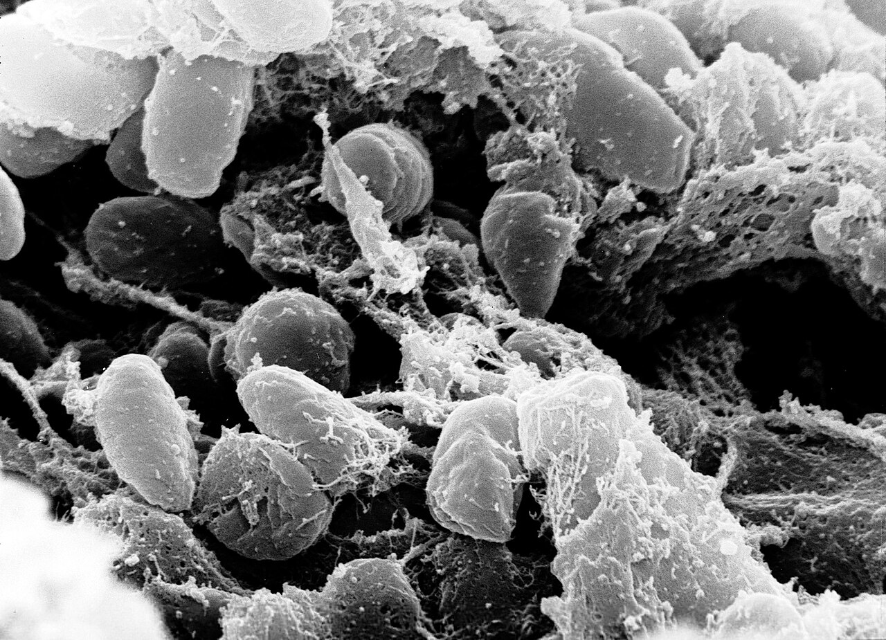 Scanning electron micrograph of Yersinia pestis, the bacterium that causes plague